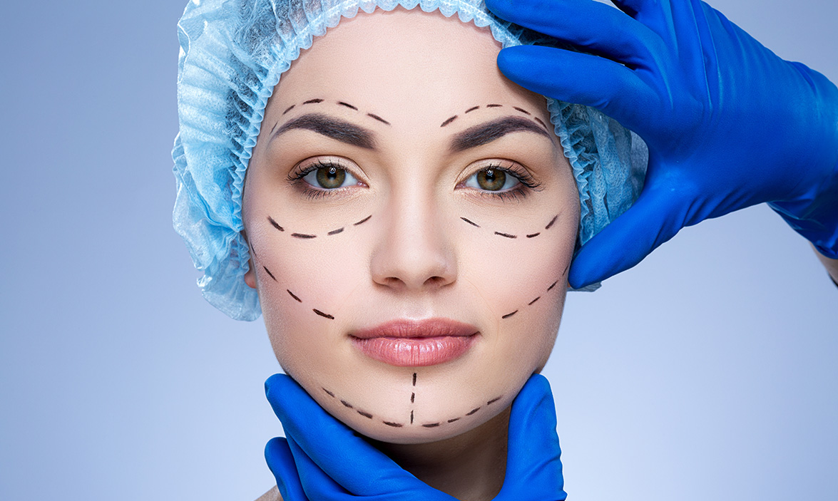 Dissolvable Threadlift