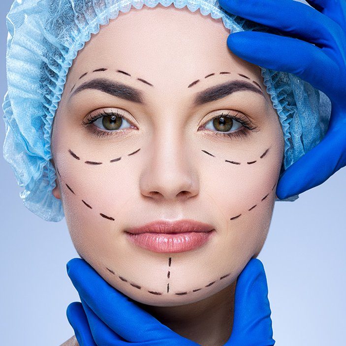 Dissolvable-threadlift-min